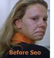 Before SEO
