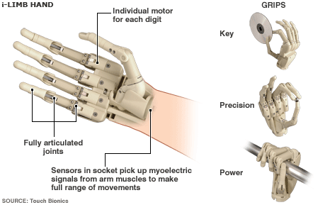 i-Limb